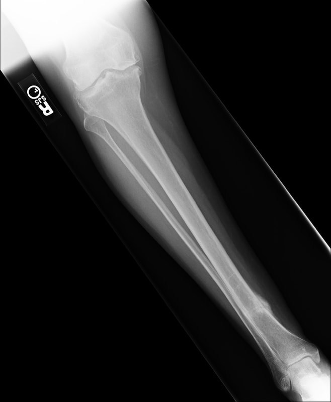 February 2020 Case Quiz Discussion Atlas Radiology Consultants